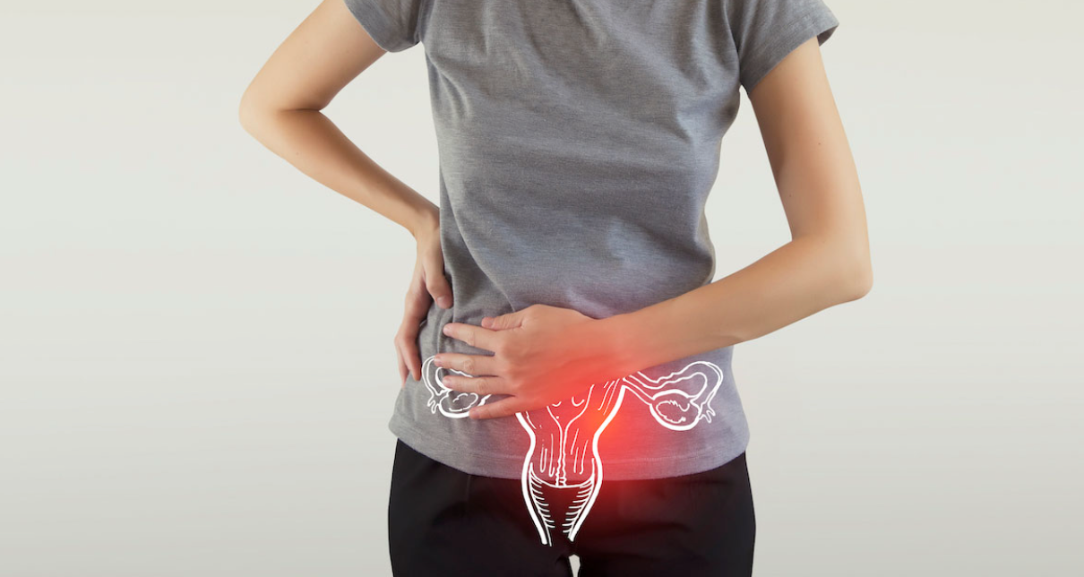 CBD Suppositories for Pelvic Discomfort: A New Solution Backed by Health Professionals