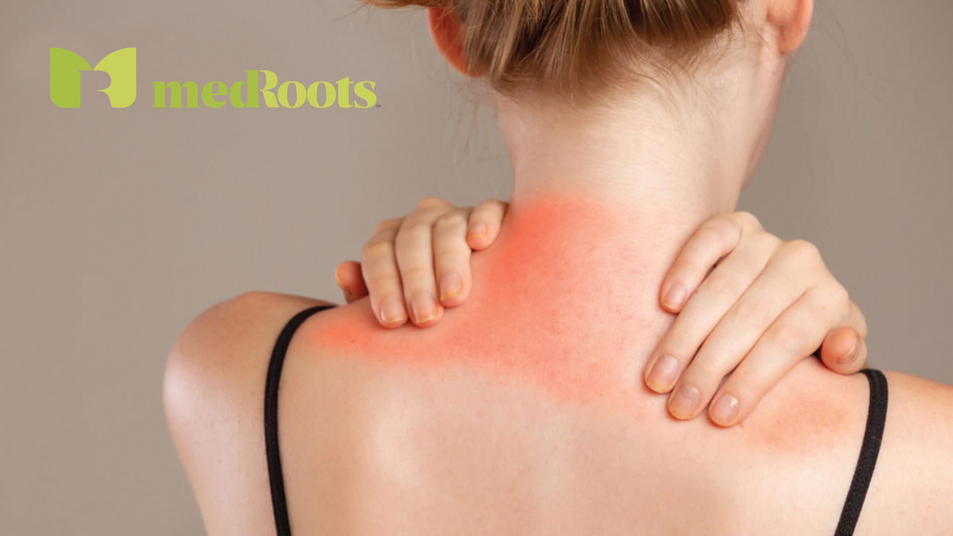 Experience On-Demand Ease with CBD Patches!